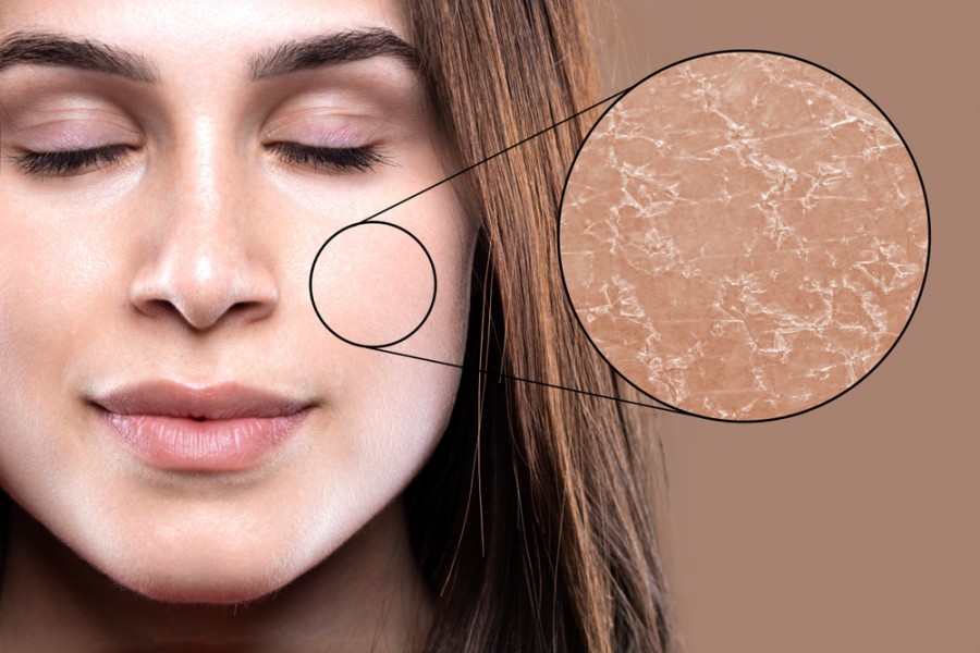 Peau visage seche : comment en prendre soin ?